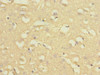 Immunohistochemistry of paraffin-embedded human brain tissue using CSB-PA015821DSR1HU at dilution of 1:100