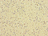 Immunohistochemistry of paraffin-embedded human adrenal gland tissue using CSB-PA015821DSR1HU at dilution of 1:100