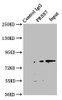 Immunoprecipitating PRSS7 in Jurkat whole cell lysate<br />
 Lane 1: Rabbit control IgG instead of CSB-PA018824ESR2HU in Jurkat whole cell lysate.
 For western blotting, a HRP-conjugated Protein G antibody was used as the secondary antibody (1/2000) <br />
 Lane 2: CSB-PA018824ESR2HU (8µg) + Jurkat whole cell lysate (500µg) <br />
 Lane 3: Jurkat whole cell lysate (10µg) <br />