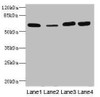 Western blot<br />
 All lanes: THBD antibody at 3.07µg/ml<br />
 Lane 1: Rat heart tissue<br />
 Lane 2: Mouse kidney tissue<br />
 Lane 3: A549 whole cell lysate<br />
 Lane 4: A431 whole cell lysate<br />
 Secondary<br />
 Goat polyclonal to rabbit IgG at 1/10000 dilution<br />
 Predicted band size: 60 kDa<br />
 Observed band size: 60 kDa<br />