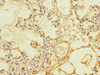 Immunohistochemistry of paraffin-embedded human lung tissue using CSB-PA023486DSR2HU at dilution of 1:100