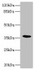 Western blot<br />
 All lanes: BST1 antibody IgG at 1.47µg/ml + Mouse lung tissue<br />
 Secondary<br />
 Goat polyclonal to rabbit IgG at 1/10000 dilution<br />
 Predicted band size: 36, 30 kDa<br />
 Observed band size: 36 kDa<br />