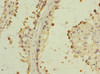 Immunohistochemistry of paraffin-embedded human testis tissue using CSB-PA734093ESR2HU at dilution of 1:100