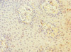 Immunohistochemistry of paraffin-embedded human tonsil tissue using CSB-PA004972ESR2HU at dilution of 1:100