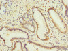 Immunohistochemistry of paraffin-embedded human pancreatic tissue using CSB-PA2107ESR1HU at dilution of 1:100