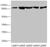 Western blot<br />
 All lanes: DSC2 antibody at 3.46µg/ml<br />
 Lane 1: Rat heart tissue<br />
 Lane 2: A549 whole cell lysate<br />
 Lane 3: HepG2 whole cell lysate<br />
 Lane 4: Jurkat whole cell lysate<br />
 Lane 5: 293T whole cell lysate<br />
 Secondary<br />
 Goat polyclonal to rabbit IgG at 1/10000 dilution<br />
 Predicted band size: 100, 94 kDa<br />
 Observed band size: 94 kDa<br />