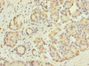 Immunohistochemistry of paraffin-embedded human pancreatic tissue using CSB-PA009438ESR1HU at dilution of 1:100