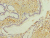 Immunohistochemistry of paraffin-embedded human pancreatic tissue using CSB-PA009438ESR2HU at dilution of 1:100