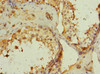 Immunohistochemistry of paraffin-embedded human testis tissue using CSB-PA731055ESR2HU at dilution of 1:100