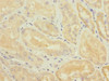 Immunohistochemistry of paraffin-embedded human kidney tissue using CSB-PA023992ESR2HU at dilution of 1:100