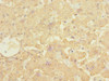 Immunohistochemistry of paraffin-embedded human liver tissue using CSB-PA614444ESR1HU at dilution of 1:100
