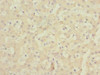 Immunohistochemistry of paraffin-embedded human liver tissue using CSB-PA614444ESR2HU at dilution of 1:100