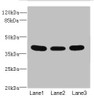 Western blot<br />
 All lanes: CD1C antibody at 3.89µg/ml<br />
 Lane 1: HepG2 whole cell lysate<br />
 Lane 2: A549 whole cell lysate<br />
 Lane 3: MCF-7 whole cell lysate<br />
 Secondary<br />
 Goat polyclonal to rabbit IgG at 1/10000 dilution<br />
 Predicted band size: 38 kDa<br />
 Observed band size: 38 kDa<br />