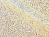 Immunohistochemistry of paraffin-embedded human tonsil tissue using CSB-PA004891ESR1HU at dilution of 1:100