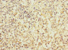 Immunohistochemistry of paraffin-embedded human spleen tissue using CSB-PA004891ESR1HU at dilution of 1:100