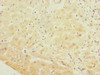 Immunohistochemistry of paraffin-embedded human heart tissue using CSB-PA009686ESR1HU at dilution of 1:100