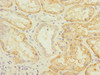 Immunohistochemistry of paraffin-embedded human kidney tissue using CSB-PA855047ESR1HU at dilution of 1:100