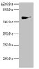 Western blot<br />
 All lanes: SLC22A8antibody IgG at 1.62µg/ml + Mouse kidney tissue<br />
 Secondary<br />
 Goat polyclonal to rabbit IgG at 1/10000 dilution<br />
 Predicted band size: 60, 61, 47, 12, 50 kDa<br />
 Observed band size: 60 kDa<br />
