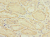 Immunohistochemistry of paraffin-embedded human kidney tissue using CSB-PA855047ESR2HU at dilution of 1:100