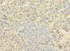 Immunohistochemistry of paraffin-embedded human adrenal gland tissue using CSB-PA855047ESR2HU at dilution of 1:100