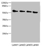 Western blot<br />
 All lanes: TRHDE antibody at 1.77µg/ml<br />
 Lane 1: Rat heart tissue<br />
 Lane 2: Mouse kidney tissue<br />
 Lane 3: 293T whole cell lysate<br />
 Lane 4: HepG2 whole cell lysate<br />
 Secondary<br />
 Goat polyclonal to rabbit IgG at 1/10000 dilution<br />
 Predicted band size: 117 kDa<br />
 Observed band size: 117 kDa<br />