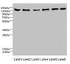 Western blot<br />
 All lanes: CD1C antibody at 4.61µg/ml<br />
 Lane 1: Mouse brain tissue<br />
 Lane 2: Mouse lung tissue<br />
 Lane 3: 293T whole cell lysate<br />
 Lane 4: HepG2 whole cell lysate<br />
 Lane 5: Jurkat whole cell lysate<br />
 Lane 6: Hela whole cell lysate<br />
 Secondary<br />
 Goat polyclonal to rabbit IgG at 1/10000 dilution<br />
 Predicted band size: 137, 134, 140 kDa<br />
 Observed band size: 137 kDa<br />