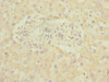 Immunohistochemistry of paraffin-embedded human liver tissue using CSB-PA768200ESR1HU at dilution of 1:100