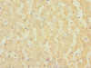 Immunohistochemistry of paraffin-embedded human liver tissue using CSB-PA768200ESR2HU at dilution of 1:100