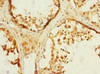 Immunohistochemistry of paraffin-embedded human testis tissue using CSB-PA880929ESR1HU at dilution of 1:100