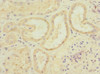 Immunohistochemistry of paraffin-embedded human kidney tissue using CSB-PA880929ESR1HU at dilution of 1:100
