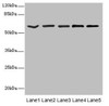 Western blot<br />
 All lanes: ASIC3 antibody at 2.4µg/ml<br />
 Lane 1: Jurkat whole cell lysate<br />
 Lane 2: HepG2 whole cell lysate<br />
 Lane 3: Hela whole cell lysate<br />
 Lane 4: A549 whole cell lysate<br />
 Lane 5: A431 whole cell lysate<br />
 Secondary<br />
 Goat polyclonal to rabbit IgG at 1/10000 dilution<br />
 Predicted band size: 59, 61, 45 kDa<br />
 Observed band size: 59 kDa<br />