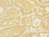 Immunohistochemistry of paraffin-embedded human kidney tissue using CSB-PA890688ESR1HU at dilution of 1:100