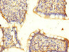 Immunohistochemistry of paraffin-embedded human small intestine tissue using CSB-PA865174ESR2HU at dilution of 1:100