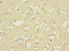 Immunohistochemistry of paraffin-embedded human brain tissue using CSB-PA002541ESR1HU at dilution of 1:100