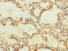 Immunohistochemistry of paraffin-embedded human lung tissue using CSB-PA889145ESR2HU at dilution of 1:100