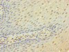 Immunohistochemistry of paraffin-embedded human tonsil tissue using CSB-PA004944ESR2HU at dilution of 1:100