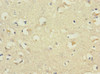 Immunohistochemistry of paraffin-embedded human brain tissue using CSB-PA897318ESR1HU at dilution of 1:100