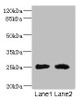 Western blot<br />
 All lanes: CEACAM4 antibody at 1.81µg/ml<br />
 Lane 1: Rat heart tissue<br />
 Lane 2: Mouse brain tissue<br />
 Secondary<br />
 Goat polyclonal to rabbit IgG at 1/10000 dilution<br />
 Predicted band size: 26 kDa<br />
 Observed band size: 26 kDa<br />