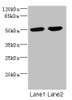 Western blot<br />
 All lanes: CHRNA10 antibody at 0.57µg/ml<br />
 Lane 1: Jurkat whole cell lysate<br />
 Lane 2: A549 whole cell lysate<br />
 Secondary<br />
 Goat polyclonal to rabbit IgG at 1/10000 dilution<br />
 Predicted band size: 50 kDa<br />
 Observed band size: 50 kDa<br />