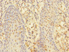 Immunohistochemistry of paraffin-embedded human tonsil tissue using CSB-PA861979ESR1HU at dilution of 1:100