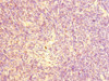 Immunohistochemistry of paraffin-embedded human thymus tissue using CSB-PA861979ESR1HU at dilution of 1:100