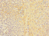 Immunohistochemistry of paraffin-embedded human tonsil tissue using CSB-PA621886ESR1HU at dilution of 1:100