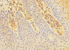 Immunohistochemistry of paraffin-embedded human tonsil tissue using CSB-PA621886ESR2HU at dilution of 1:100