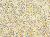 Immunohistochemistry of paraffin-embedded human spleen tissue using CSB-PA621886ESR2HU at dilution of 1:100