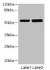 Western blot<br />
 All lanes: CHRNE antibody at 1.87µg/ml<br />
 Lane 1: Hela whole cell lysate<br />
 Lane 2: HepG2 whole cell lysate<br />
 Secondary<br />
 Goat polyclonal to rabbit IgG at 1/10000 dilution<br />
 Predicted band size: 55 kDa<br />
 Observed band size: 55 kDa<br />