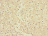 Immunohistochemistry of paraffin-embedded human liver tissue using CSB-PA005400ESR1HU at dilution of 1:100