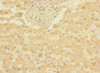 Immunohistochemistry of paraffin-embedded human liver tissue using CSB-PA005400ESR2HU at dilution of 1:100