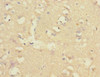Immunohistochemistry of paraffin-embedded human brain tissue using CSB-PA005692ESR1HU at dilution of 1:100