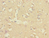 Immunohistochemistry of paraffin-embedded human brain tissue using CSB-PA005692ESR1HU at dilution of 1:100