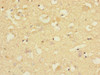 Immunohistochemistry of paraffin-embedded human brain tissue using CSB-PA005692ESR2HU at dilution of 1:100